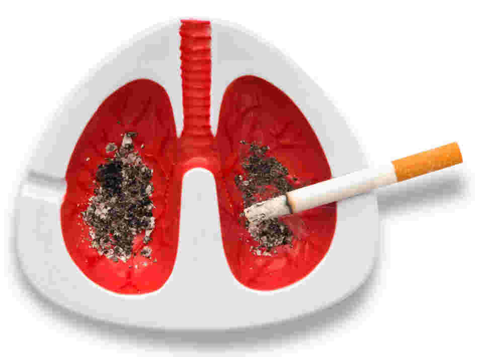 An artist's rendering of lungs filled with nicotine