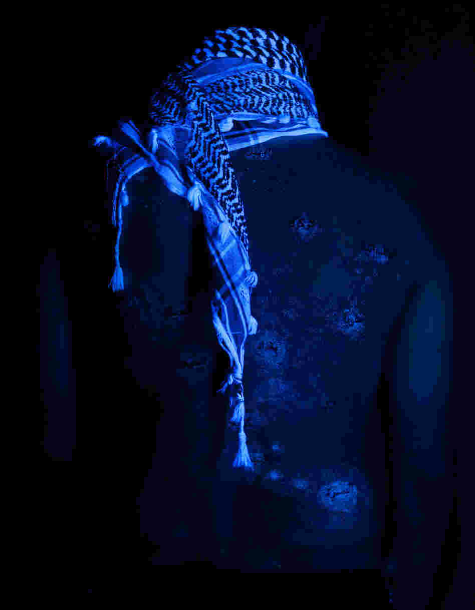 Wafaa Bilal's back as seen under a black light