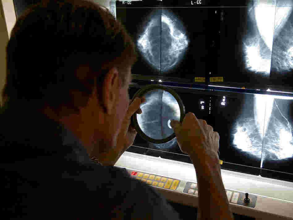 A radiologist reading a mammogram