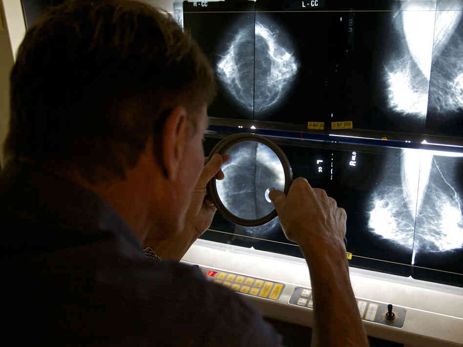 A radiologist reading a mammogram