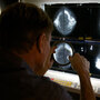 A radiologist reading a mammogram