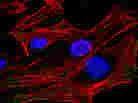 HeLa Cells HeLa Cells