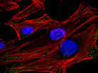 HeLa Cells HeLa Cells