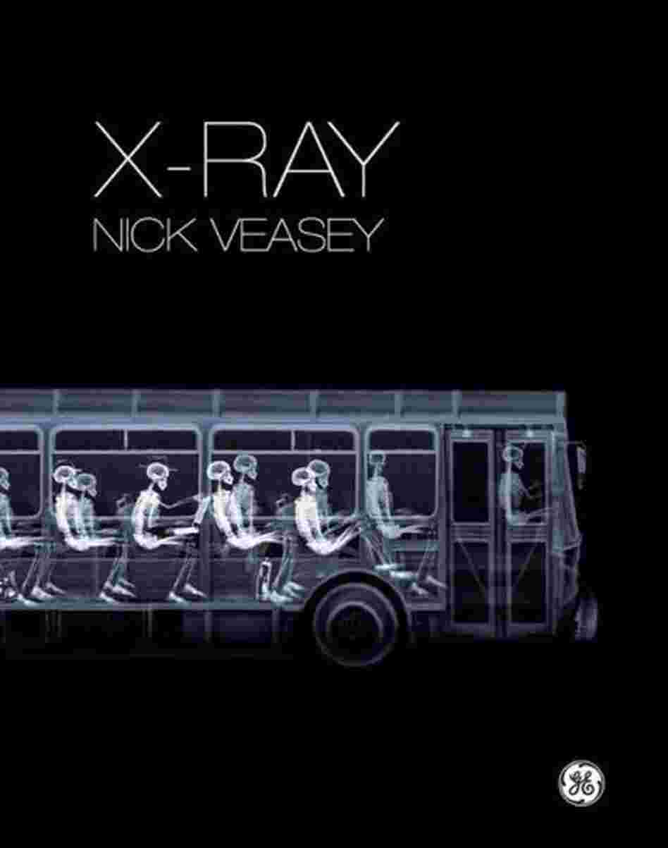 X-Ray