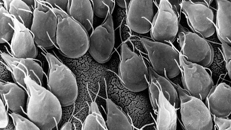 Giardia protozoa in the small intestine of a gerbil