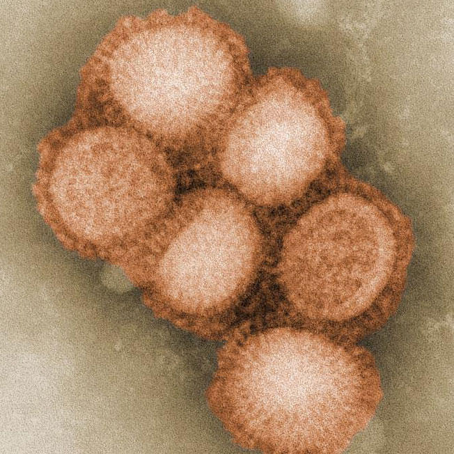 swine flu virus