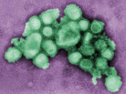 Swine flu virus Swine flu virus