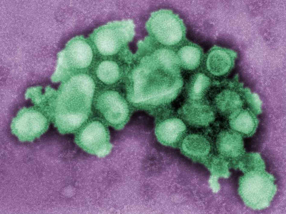 Swine flu virus