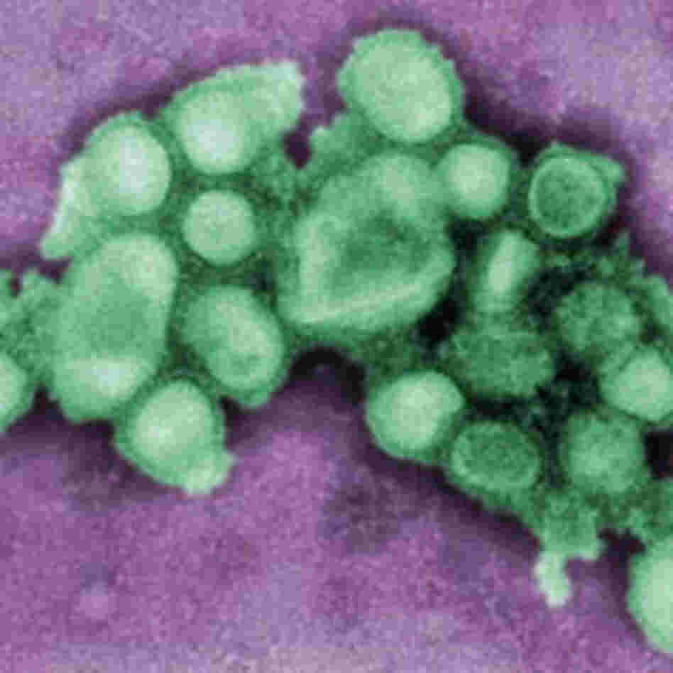 h1n1. h1n1.