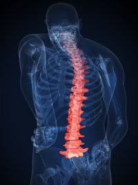 x-ray illustration of aching back