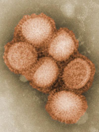swine flu h1n1 virus.