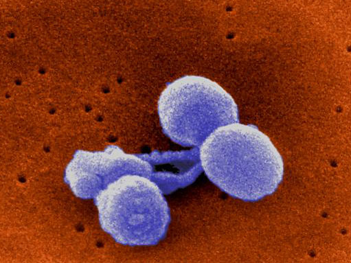 Streptococcus pneumoniae heightens health risks for people who catch swine flu.