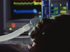 A man breathing with the help of a ventilator lies in a hospital bed. A man breathing with the help of a ventilator lies in a hospital bed.