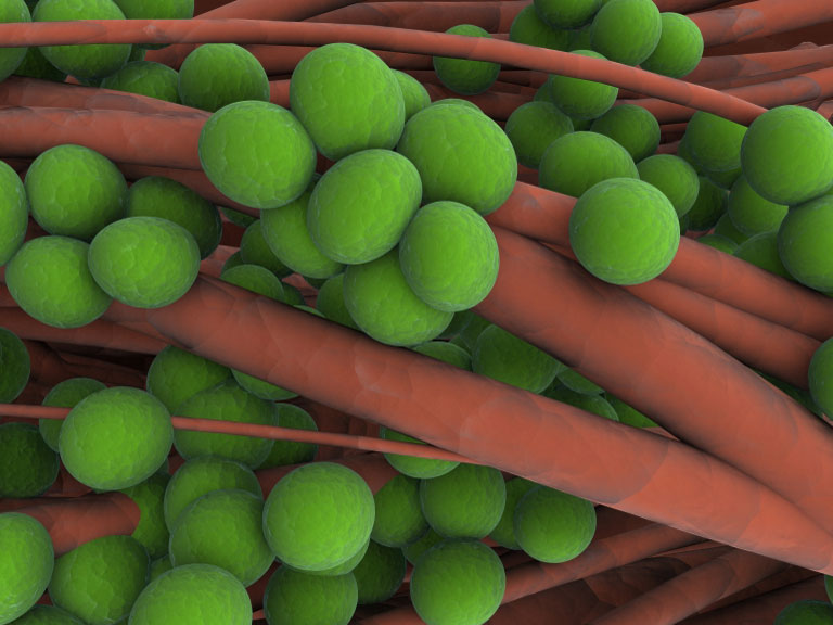 Staphylococcus aureus.