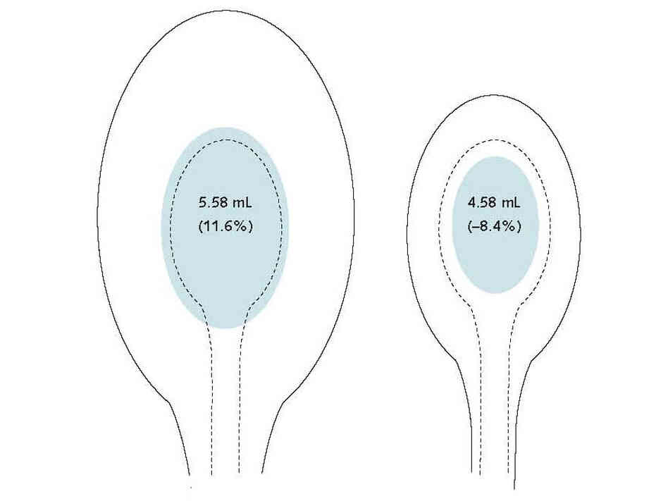 Spoons.