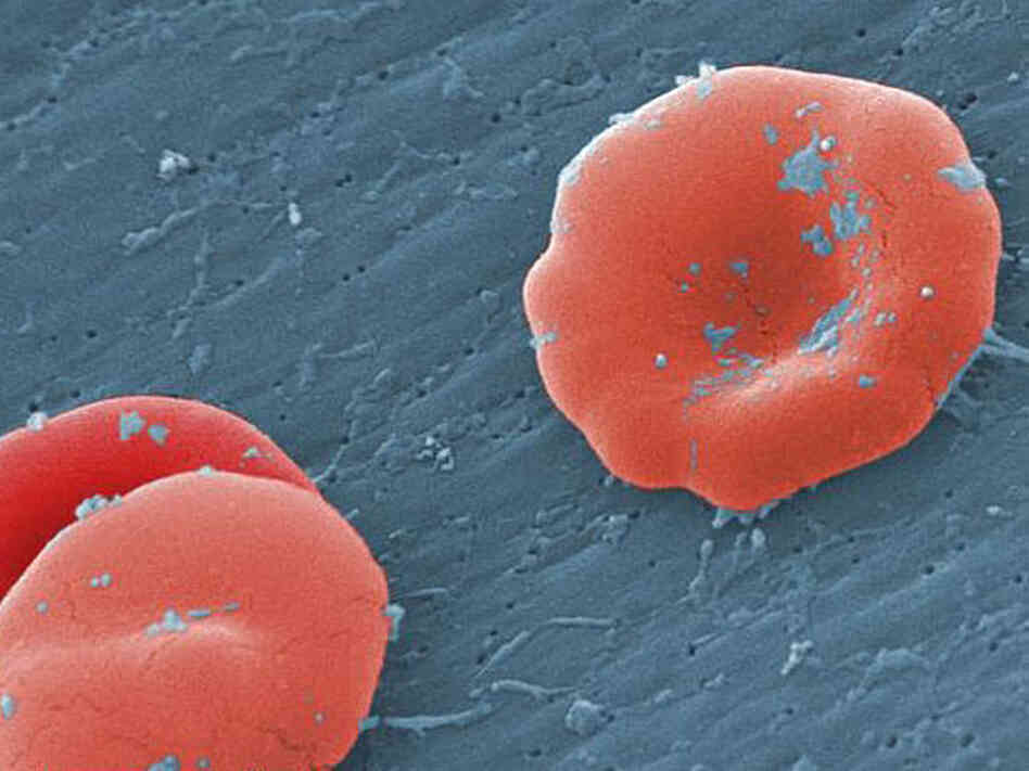 Red blood cells.