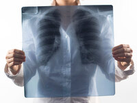 Woman holding an X-ray