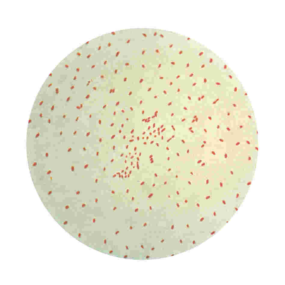 Bordatella bacteria that cause whooping caugh Bordatella bacteria that cause whooping caugh