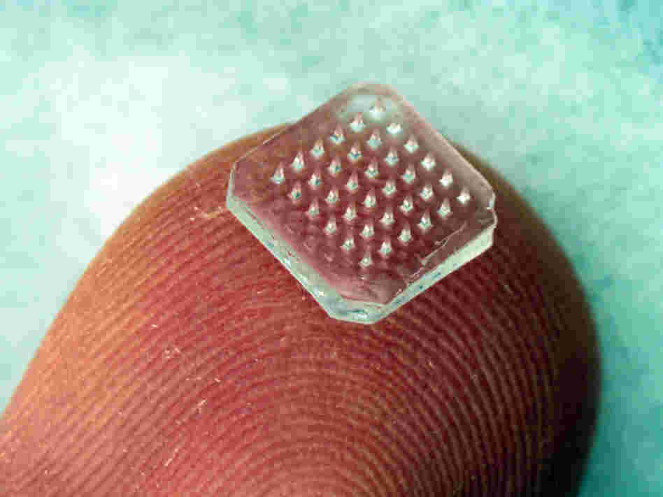 Microneedle patch