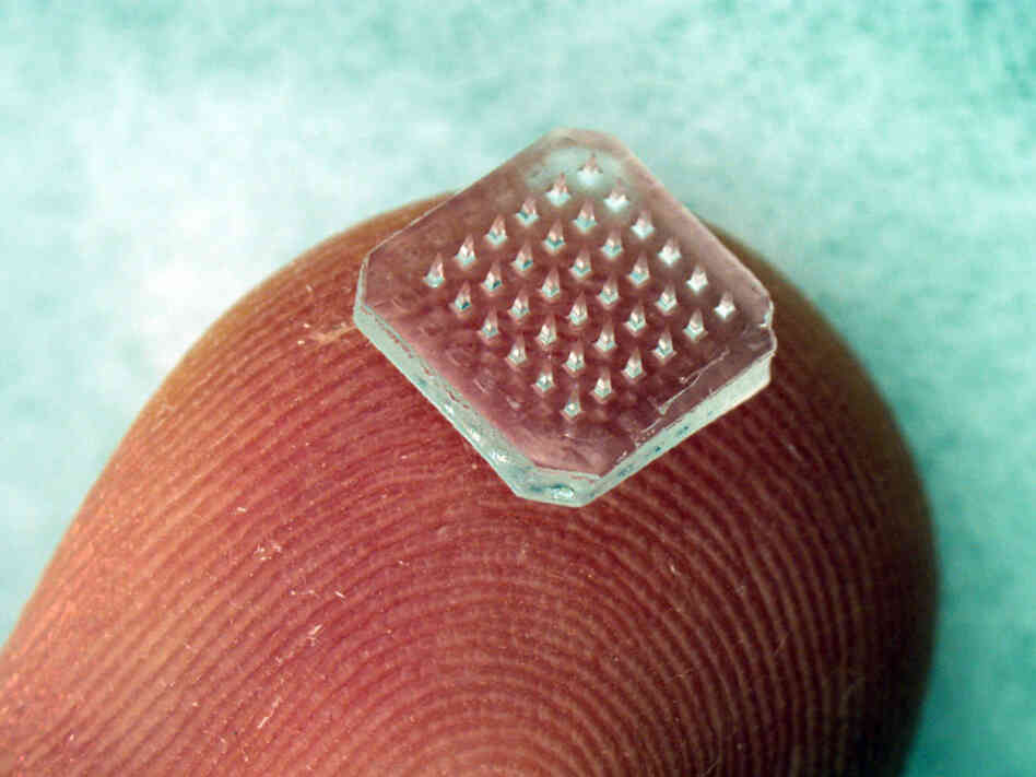 Microneedle patch