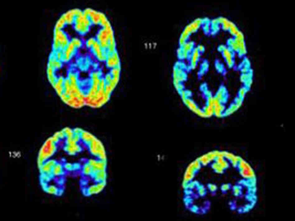 Brain scan Brain scan