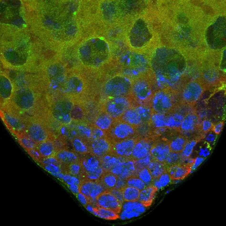 The Birthplace Of Fruit Fly Sperm: Male fruit fly sex cells are born here and grow into large cells that subsequently divide to form sperm cells. 