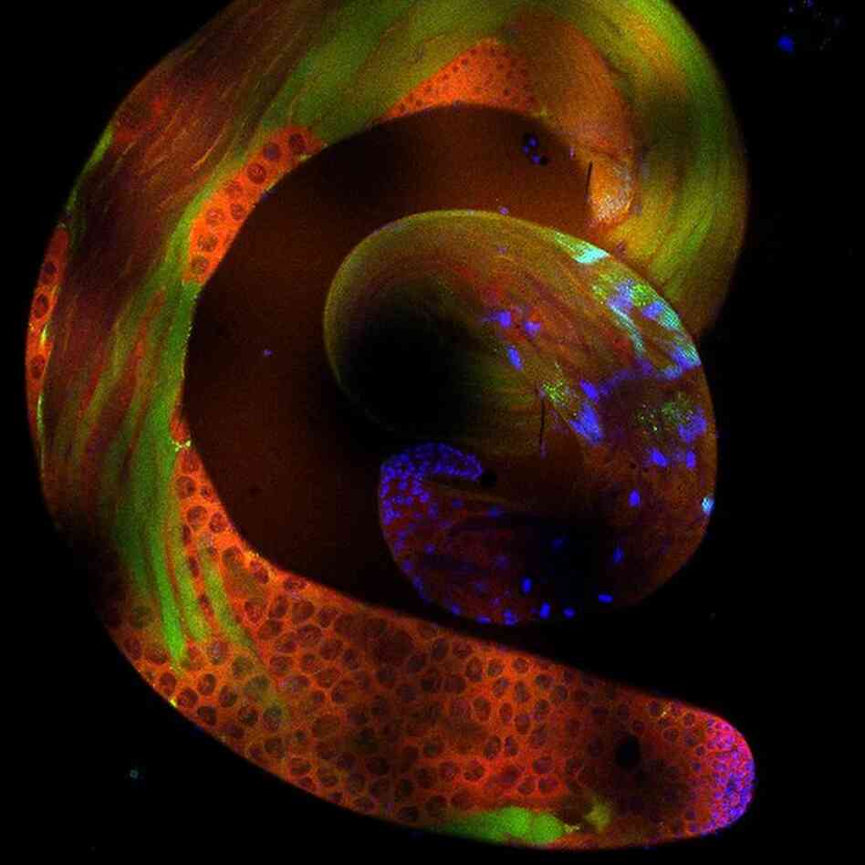 The male testis of the fruit fly. 