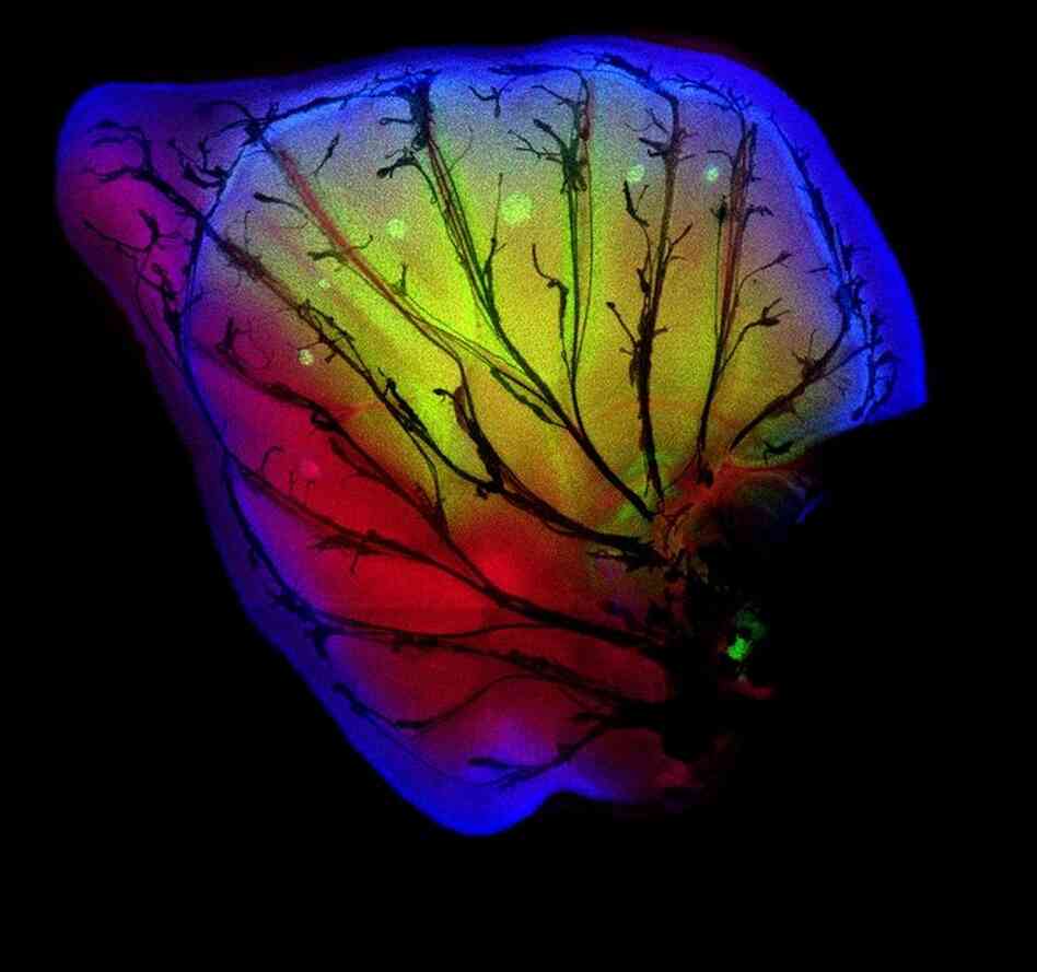 This structure, known as an imaginal disc, is the developing wing of the African butterfly Bicyclus anynana. 