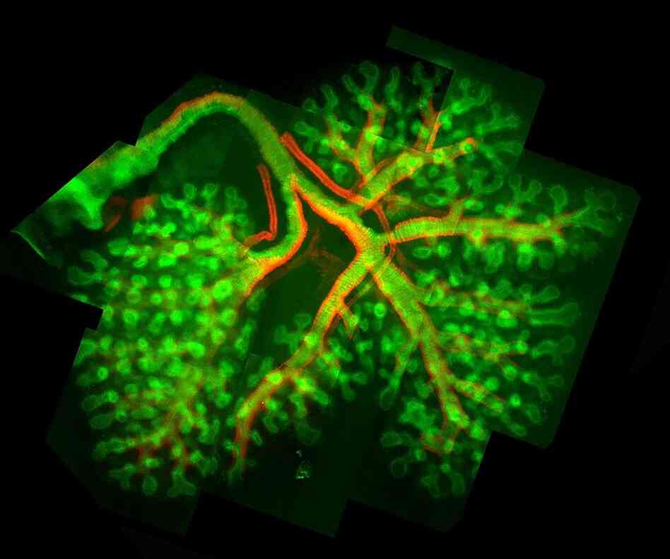 A Normal Mouse Fetal Lung: Different colored stains outline airways (green) and smooth muscle (red). 