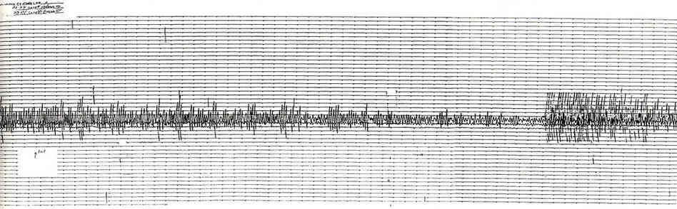 One lesson seismologists learned in 1989 was that much of the monitoring equipment scattered around California was too sensitive for powerful quakes like Loma Prieta, which essentially overloaded the instruments. Above is a seismogram from the 1989 quake; note how the reading is clipped during the most violent shaking. Since then, accelerometers have been installed at monitoring sites to captur...
