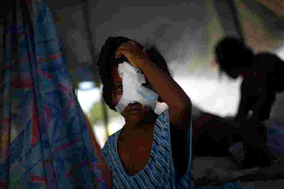 A Haitian girl, whose nose and cheek were shattered in the quake, holds her head at the main hospital in downtown in Port-au-Prince.