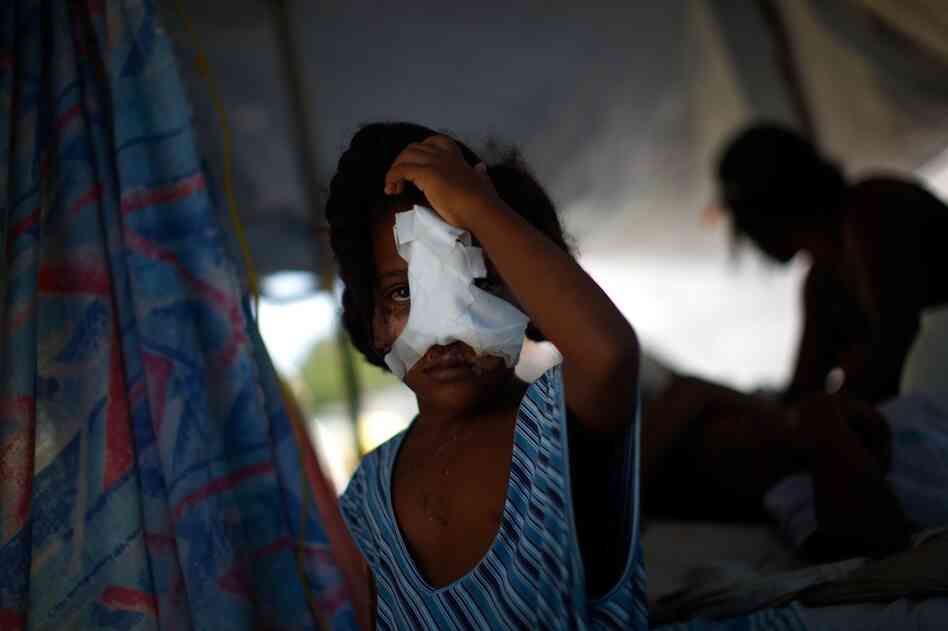 A Haitian girl, whose nose and cheek were shattered in the quake, holds her head at the main hospital in downtown in Port-au-Prince.
