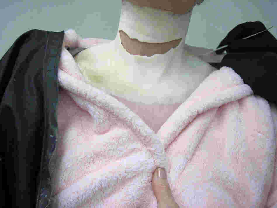 A thin piece of latex foam with a slit cut into it is placed on the actress' neck, pulled tight and glued down. 