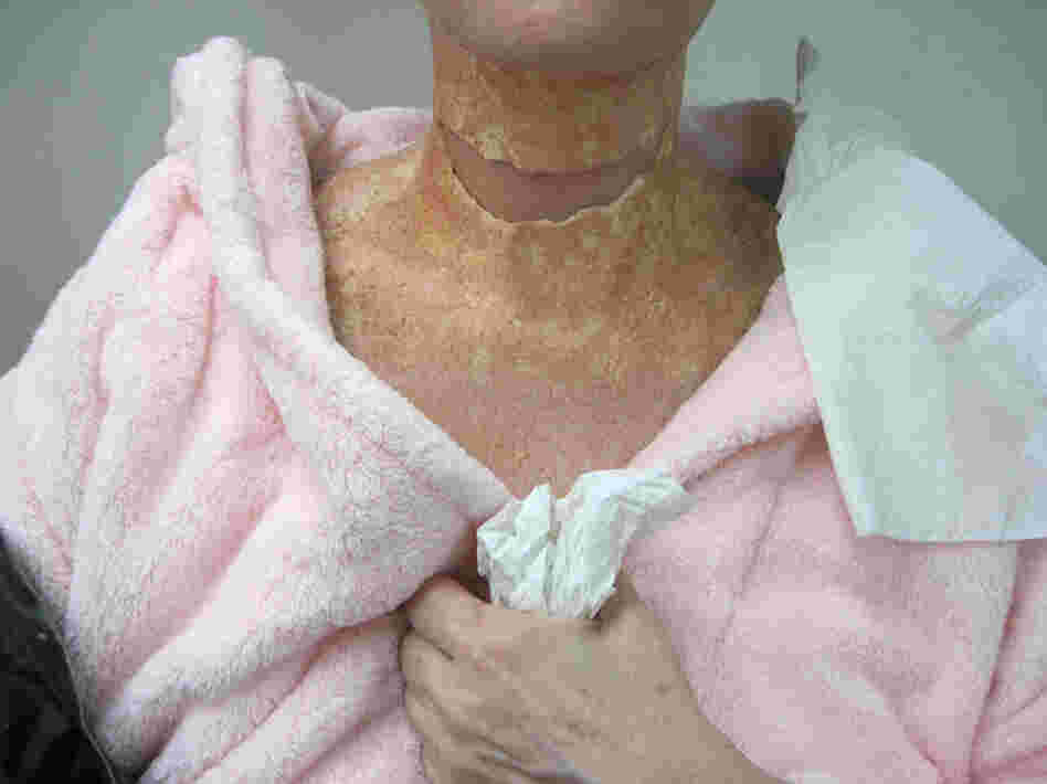 The makeup artists dab various tones of flesh-colored makeup and spray pale brown dots onto the actress' new "neck" to create a natural look.