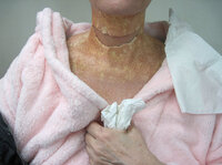 The makeup artists dab various tones of flesh-colored makeup and spray pale brown dots onto the actress' new