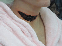 Volia! A gaping wound!