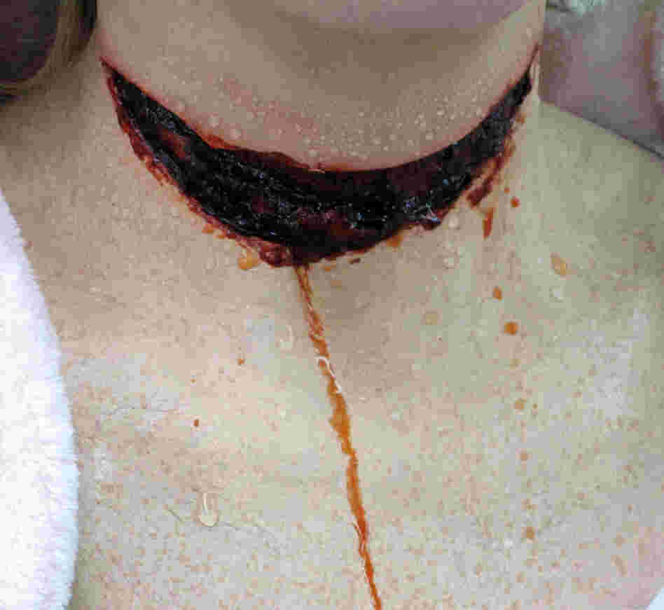 Adding water makes the wound look drippy.  For the final effect (which, sorry, we can't show you) "blood" will be splattered all over the actress' neck.