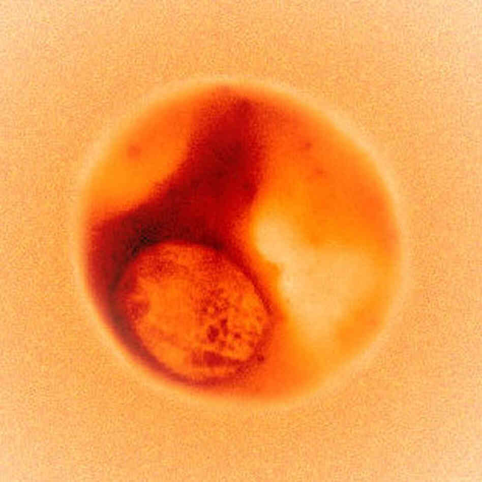 malaria in red blood cell malaria in red blood cell
