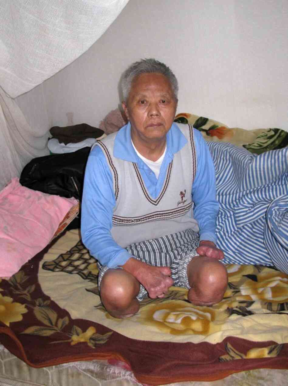 Over the past 16 years, Nanputuo Temple has given out about $7 million in aid. One recipient is a small hospital for leprosy patients on a hillside outside Xiamen. Many of the patients have lived there for decades after their families abandoned them.