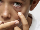 Boy puts contact lens in eye Boy puts contact lens in eye