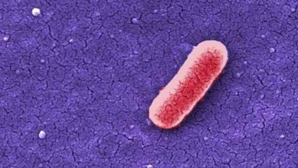 Colorized scanning electron micrograph (SEM) depicted a single Gram-negative Escherichia coli. Colorized scanning electron micrograph (SEM) depicted a single Gram-negative Escherichia coli.