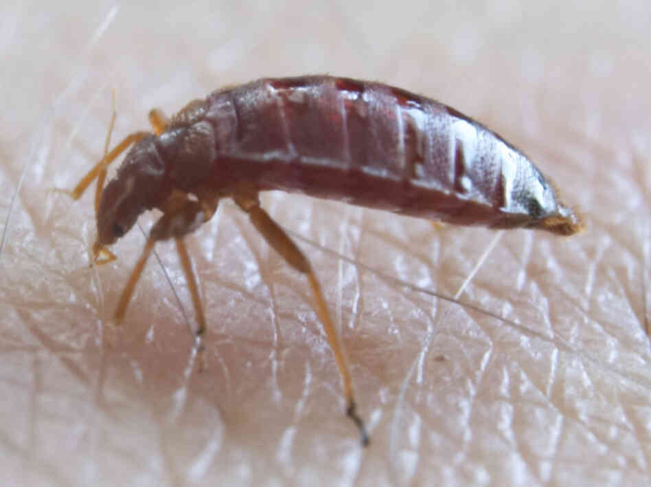 A bedbug. Jiří Humpolíček/Wikimedia Commons A bedbug. Jiří Humpolíček/Wikimedia Commons
