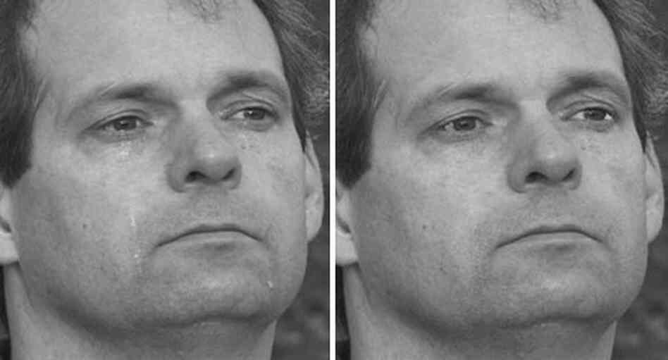 Example of tear and non-tear photos from a study by Randolph Cornelius Example of tear and non-tear photos from a study by Randolph Cornelius