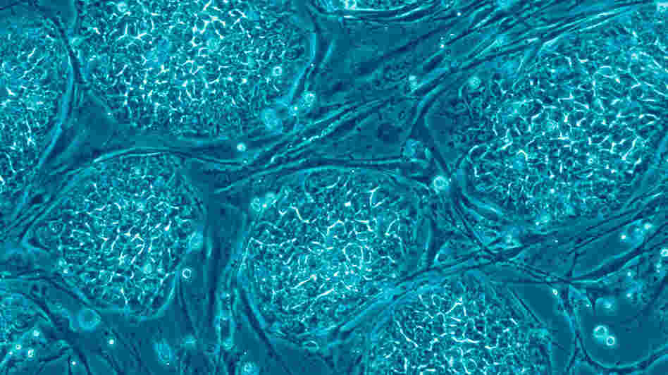 Human embryonic stem cells Human embryonic stem cells