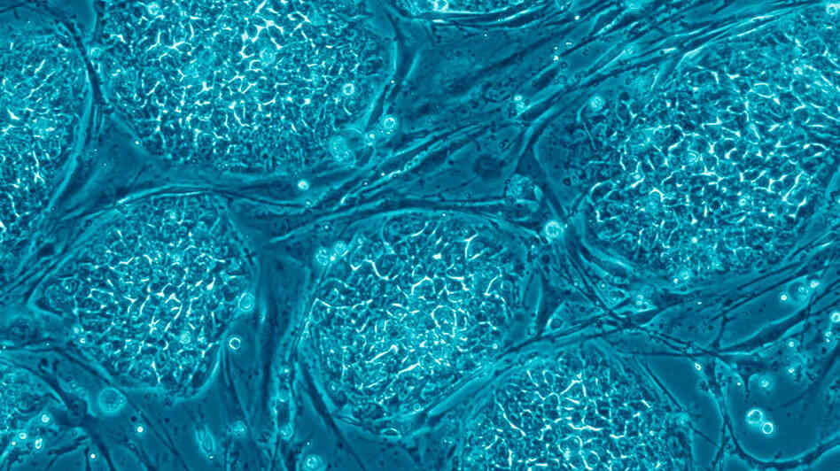 Human embryonic stem cells Human embryonic stem cells