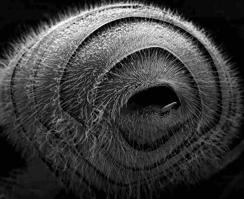 abdomen 23xForeshortened view of the abdomen with sting.