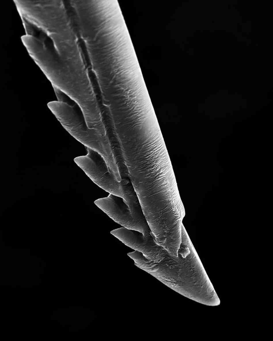sting 650xWhen a bee stings a person, bear, skunk, or other mammal, the barbs of the sting become anchored in the flesh. As she tries to free herself, the last segment of her abdomen is ripped out as she dies.