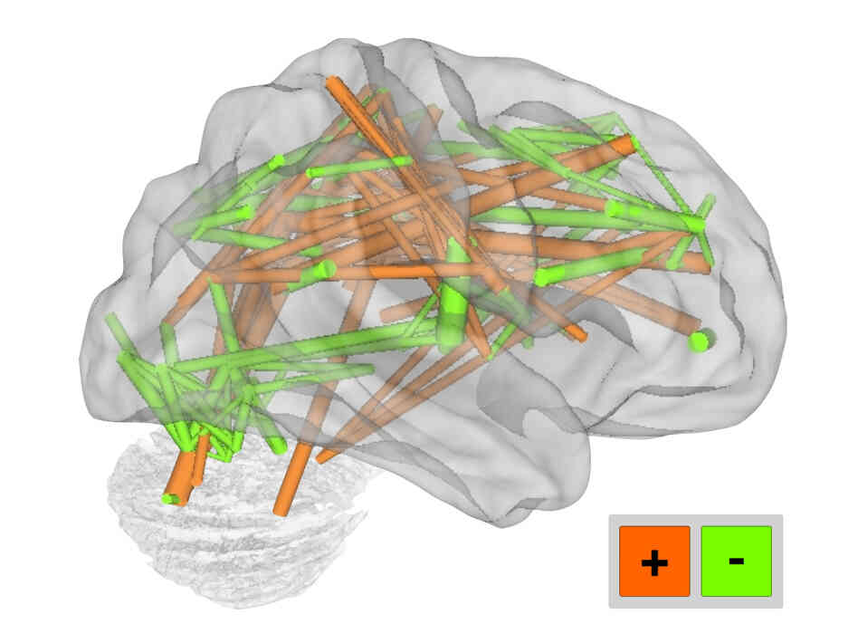 Functional brain connections from MRI data