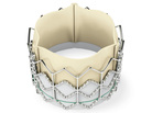 SAPIEN aortic valve SAPIEN aortic valve