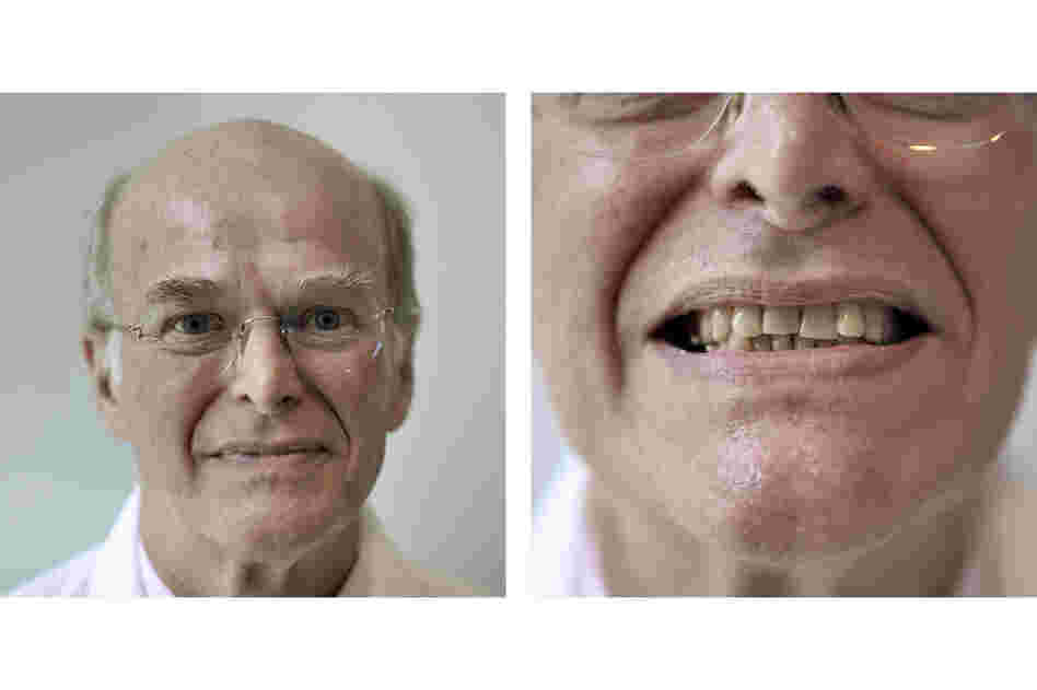 Orthodontist Robert Williams never had braces, and has no plans to improve his teeth. Invisalign, a clear orthodontic device, might straighten his front teeth, he says, but it's not worth the problems it would cause for his back teeth.